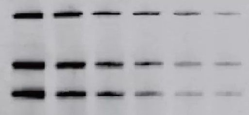 Western Blotting